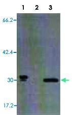 Pab14868-dimensiune : 100 micrograme-anticorp policlonal Anti-LGALS3 iepure-fiecare